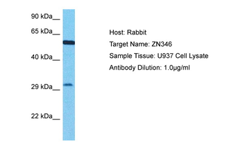 ZNF346 Rabbit Polyclonal Antibody