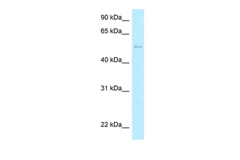 HARS2 Rabbit Polyclonal Antibody