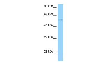 HARS2 Rabbit Polyclonal Antibody