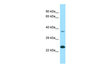 EPDR1 Rabbit Polyclonal Antibody
