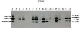 SFTPA2 Rabbit Polyclonal Antibody