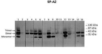 SFTPA2 Rabbit Polyclonal Antibody