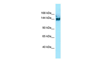 SYNGAP1 Rabbit Polyclonal Antibody