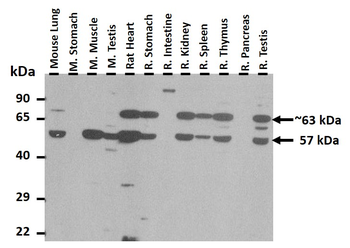 NT5E Rabbit Polyclonal Antibody