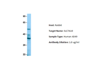 SLC7A10 Rabbit Polyclonal Antibody
