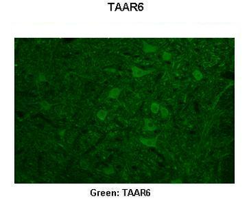 TAAR6 Rabbit Polyclonal Antibody