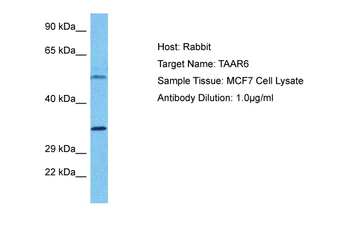 TAAR6 Rabbit Polyclonal Antibody