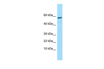 TREH Rabbit Polyclonal Antibody