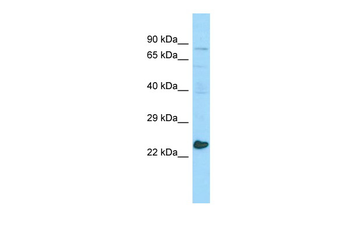 MED20 Rabbit Polyclonal Antibody