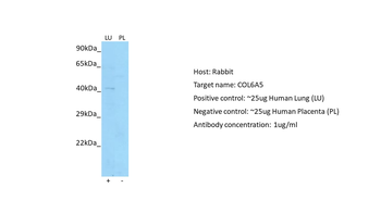 COL6A5 Rabbit Polyclonal Antibody