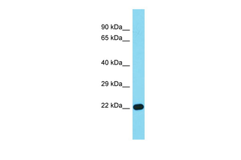 IFNE Rabbit Polyclonal Antibody
