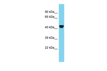 AAR2 Rabbit Polyclonal Antibody