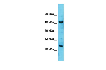 COA6 Rabbit Polyclonal Antibody