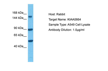 CLUH Rabbit Polyclonal Antibody