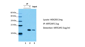 KRTCAP2 Rabbit Polyclonal Antibody
