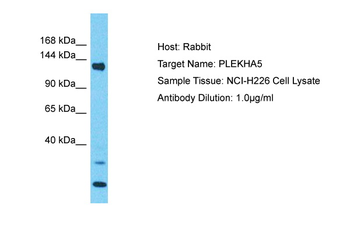 PLEKHA5 Rabbit Polyclonal Antibody