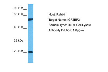 IGF2BP3 Rabbit Polyclonal Antibody