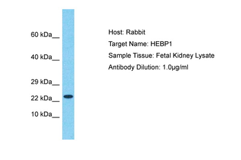 HEBP1 Rabbit Polyclonal Antibody