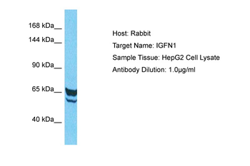 IGFN1 Rabbit Polyclonal Antibody