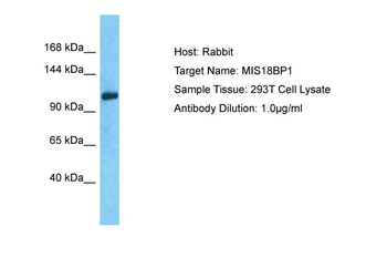 MIS18BP1 Rabbit Polyclonal Antibody