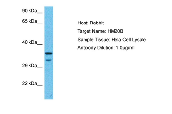 HMG20B Rabbit Polyclonal Antibody