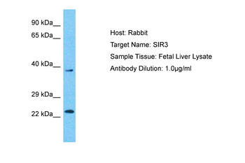 SIRT3 Rabbit Polyclonal Antibody