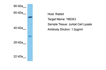 YBX3 Rabbit Polyclonal Antibody