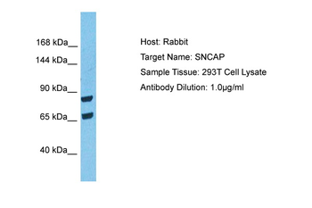 SNCAIP Rabbit Polyclonal Antibody