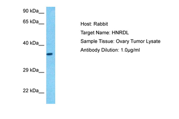 HNRNPDL Rabbit Polyclonal Antibody