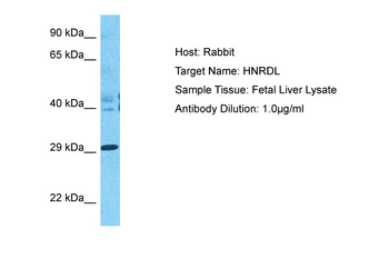 HNRNPDL Rabbit Polyclonal Antibody