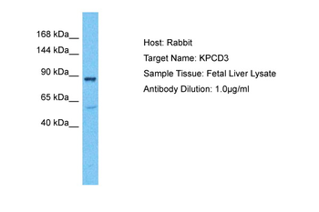 PRKD3 Rabbit Polyclonal Antibody