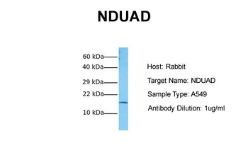 NDUFA13 Rabbit Polyclonal Antibody