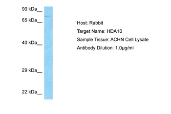 HDAC10 Rabbit Polyclonal Antibody