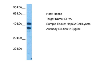 AGXT Rabbit Polyclonal Antibody