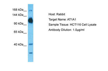 ATP1A1 Rabbit Polyclonal Antibody