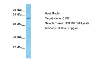 CYP11B1 Rabbit Polyclonal Antibody