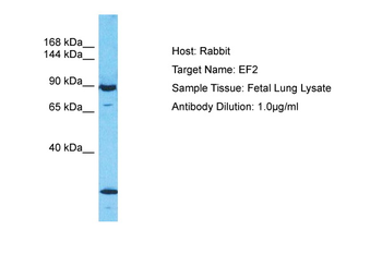 EEF2 Rabbit Polyclonal Antibody