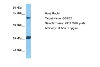 GABRB2 Rabbit Polyclonal Antibody