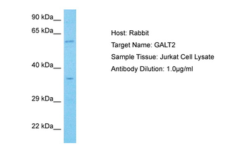 GALNT2 Rabbit Polyclonal Antibody