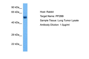 PPP3CB Rabbit Polyclonal Antibody