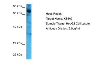 RPS6KA3 Rabbit Polyclonal Antibody