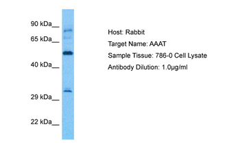 SLC1A5 Rabbit Polyclonal Antibody