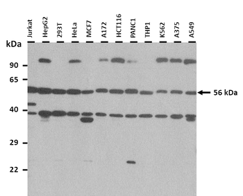 USP14 Rabbit Polyclonal Antibody