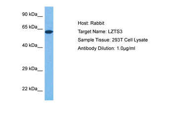 LZTS3 Rabbit Polyclonal Antibody