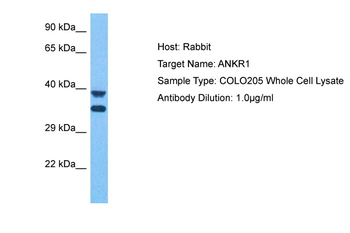 ANKRD1 Rabbit Polyclonal Antibody
