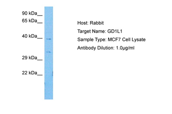 GDAP1L1 Rabbit Polyclonal Antibody