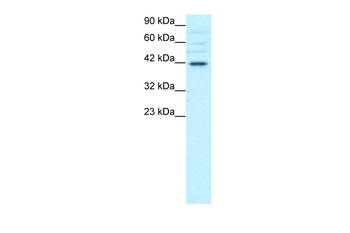 POU3F4 Rabbit Polyclonal Antibody