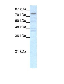 EOMES Rabbit Polyclonal Antibody