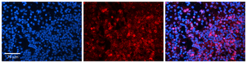 MYC Rabbit Polyclonal Antibody