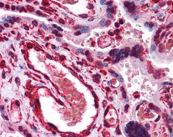 LIPG Rabbit Polyclonal Antibody